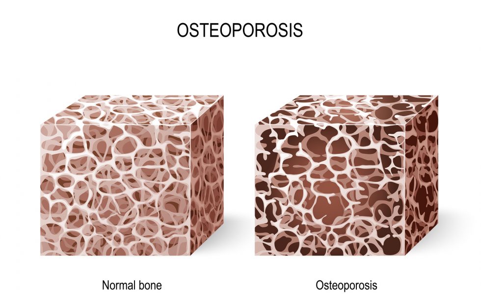 Herbs for improving bone health and reducing osteoporosis