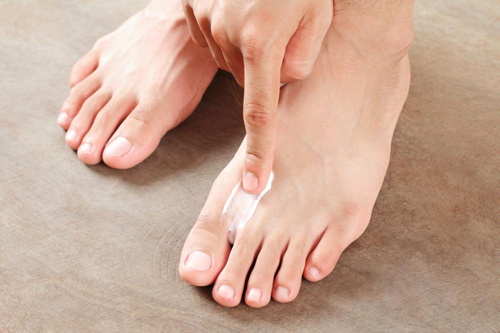 Herbs for reducing symptoms of athletes foot